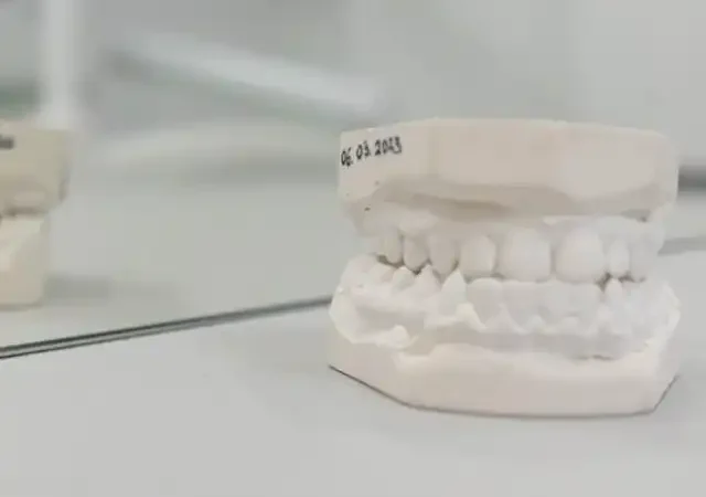 Aparate Dentare: Soluția Modernă pentru O Dantură Perfect Aliniată