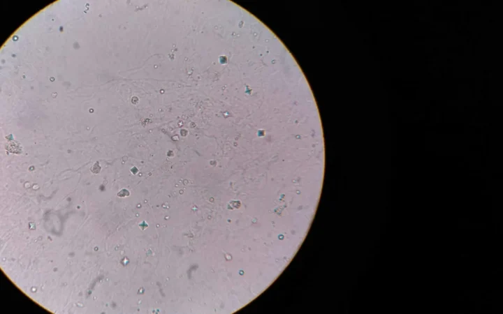 Bacterii vechi de 5.000 de ani descoperite în Peștera Scărișoara, speranță împotriva rezistenței la antibiotice